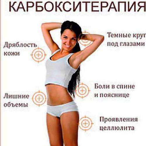 КАРБОКСИТЕРАПИЯ 